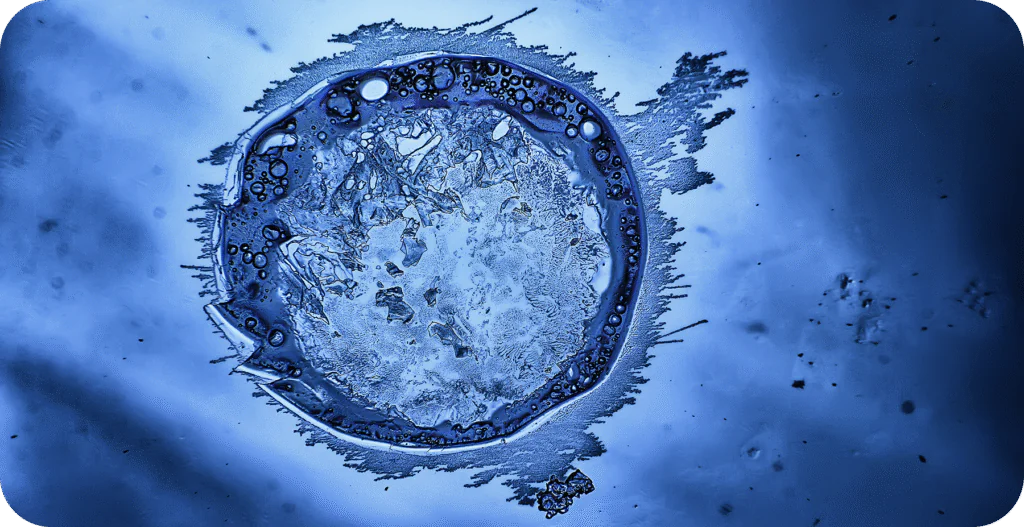 Egg Freezing: Is It Right for You? - AAS Fertility & IVF Center